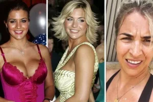 Gemma Atkinson’s Bold Take on Breast Enlargement and Dismissal of Botox