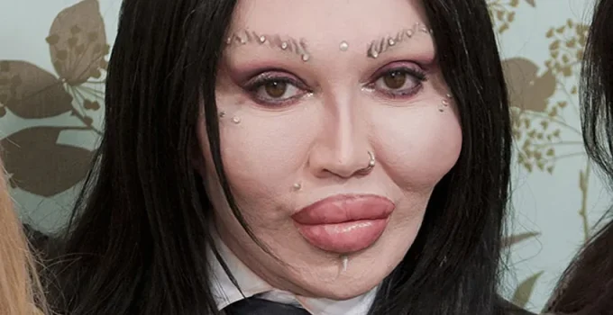 Pete Burns