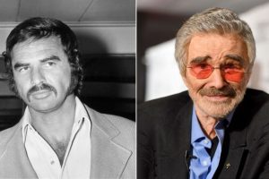 Burt Reynolds’ Eye Surgery and Hair Transplant Speculations Explained