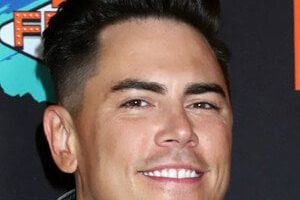 Tom Sandoval’s Botox Treatment and Evolving Plastic Surgery Journey