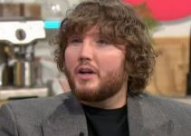 James Arthur’s Nose Job and Botox: The Truth Behind His Transformation