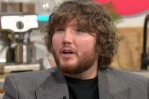 James Arthur’s Nose Job and Botox: The Truth Behind His Transformation