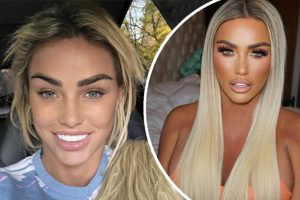 Katie Price’s Journey Through Plastic Surgery: Breast Enhancements and Botox