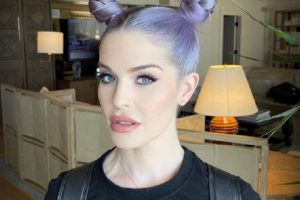 Kelly Osbourne’s Journey: Lip Enhancements and Plastic Surgery Speculations