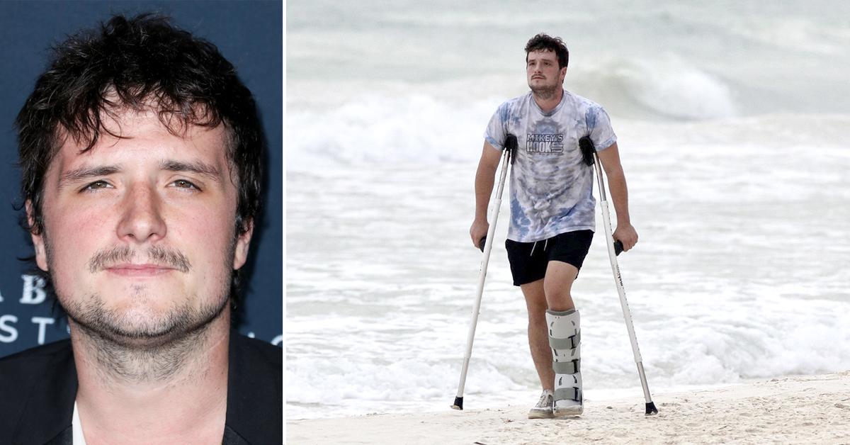 Josh Hutcherson's Refined Look After Rhinoplasty
