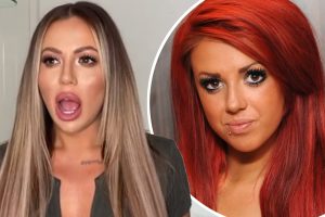 Holly Hagan’s Plastic Surgery: Boob Job, BBL, Botox, and Lip Fillers