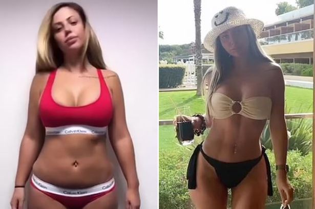 Holly Hagan Toned Curves Boosted By Plastic Surgery
