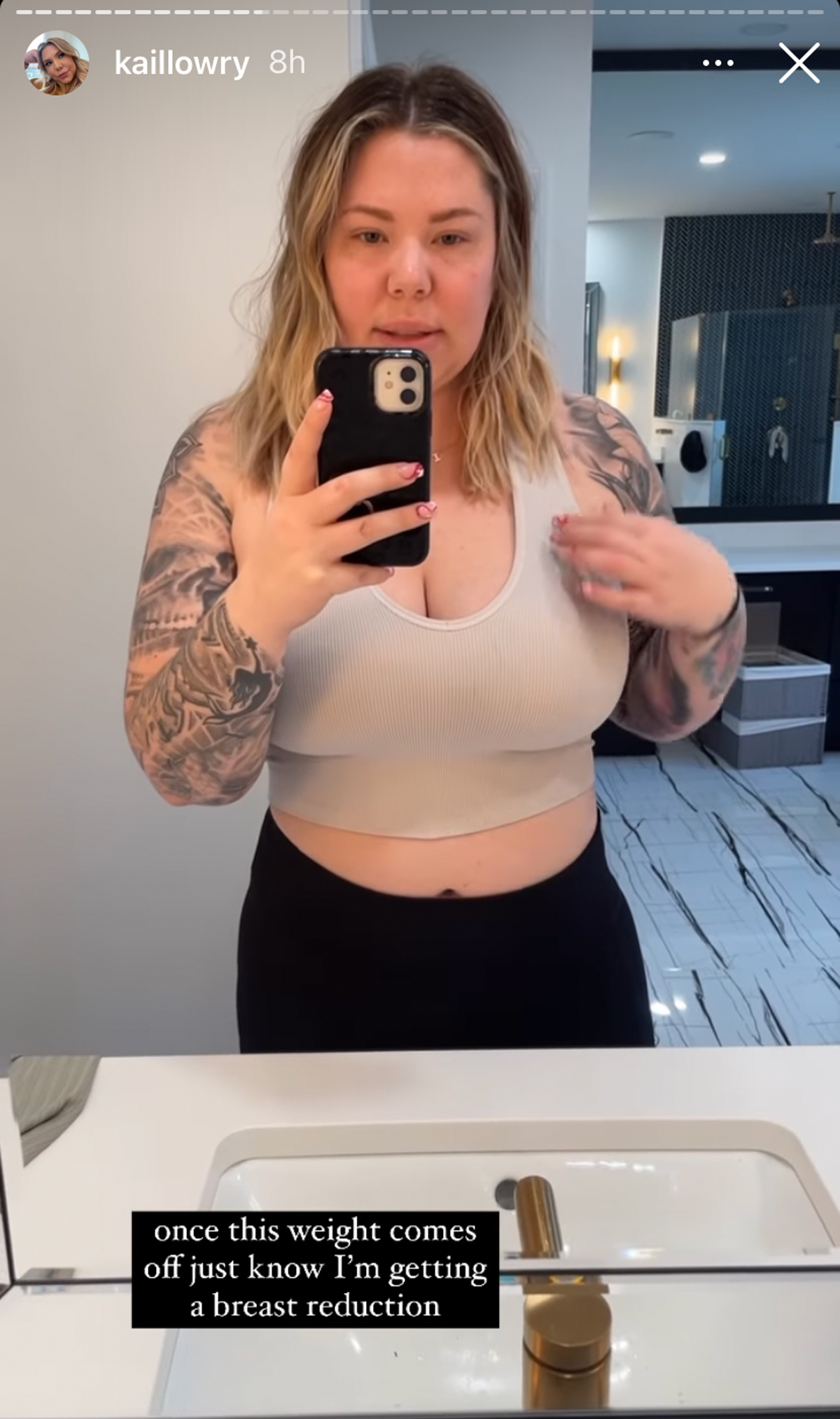 Kailyn Lowry Breast Reduction Plastic Surgery